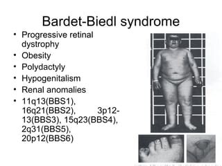 bardet-biedl syndrome 13